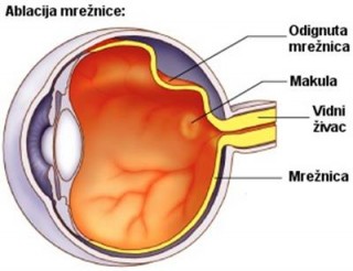 oftalmoloski pojmovnik
