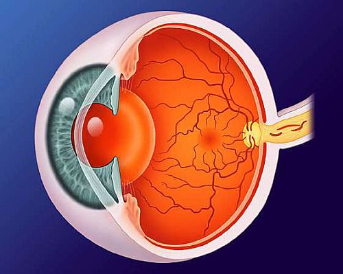 Atrofia nervului optic - cauze, simptome, tratament